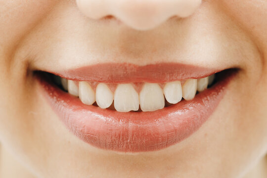 Wide smile of young fresh woman with great healthy white teeth. Closeup of woman smiling with prefect white teeth