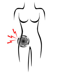 Stylized female body with pain point appendix