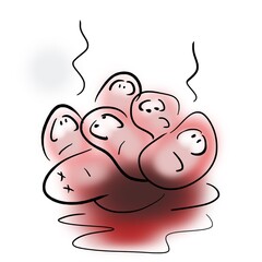 Aggregation of red blood cells