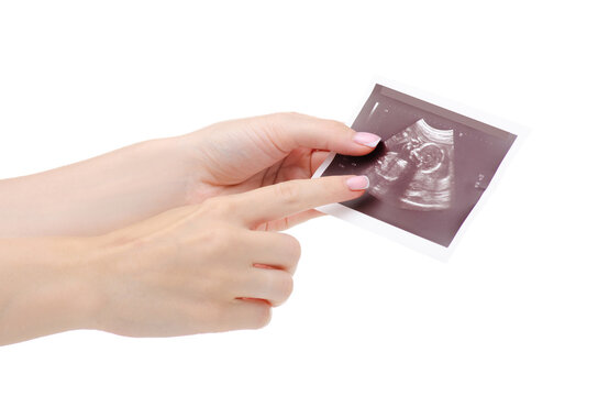 Woman holding ultrasound film close up, isolated on white background.