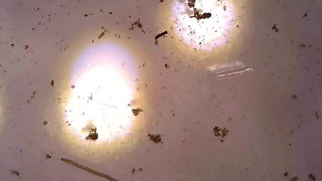 Microscope Zooplankton Freshwater Pond Nauplius Larva 300x
