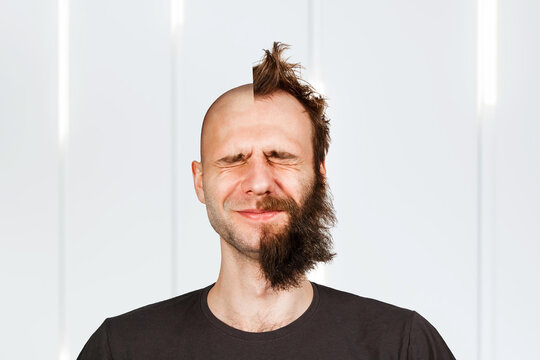 Man with half shaved hair head. Guy before and after transplant and alopecia.