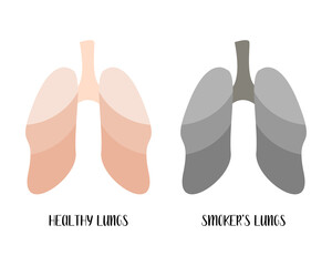 Healthy lungs and smoker's lungs. Pulmonology. Vector flat cartoon illustration. Perfect for banner, medical brochure, flyer
