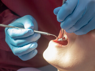 Operation with dental or dental hygienist patient. Woman with calculus or bruise. Oral Doctor...