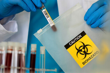 Lab professional putting vial into string bag with biohazard sign