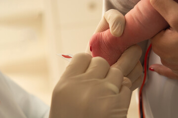 closeup of examining foot in newborn, (foot test)