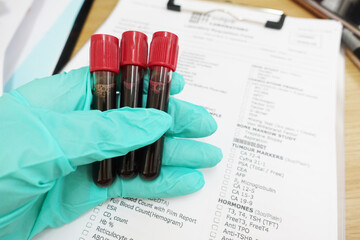 Blood test in laboratory in hospital
