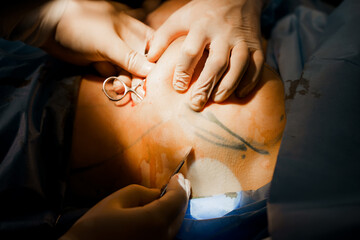 Chest augmentation plastic operation and correction in medical clinic. Surgeon touches and check...