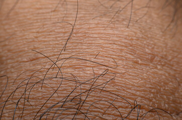 close up of human skin
