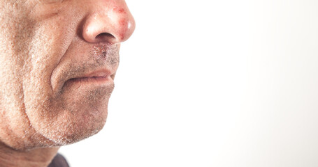 Fototapeta premium Caucasian man face. After the fight