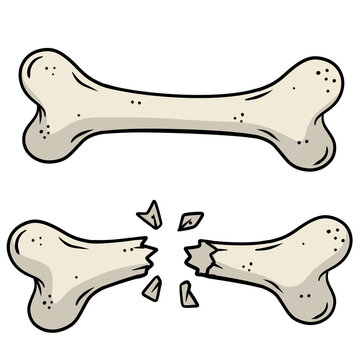 Bone fracture. Trauma to the body. Crack and splinters. Dangerous situation and wound. Cartoon flat illustration and dog toy isolated on white background