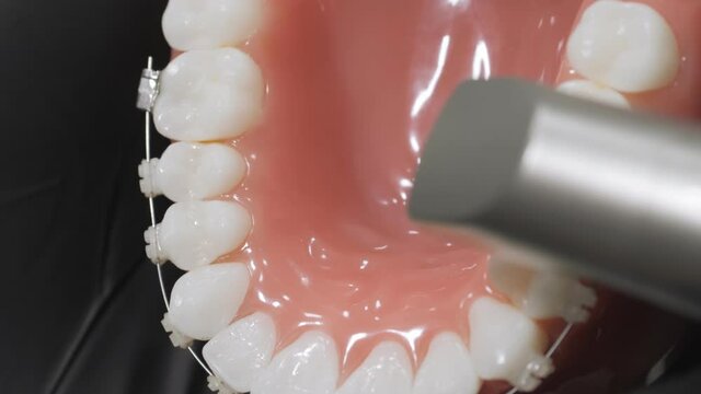 Polymerization LED lamp. Installation of the bracket system. Model Jaw.