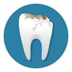 tooth cavity