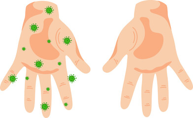 The palms of the hands. Vector flat illustration. One hand is clean,the other hand has germs and viruses.