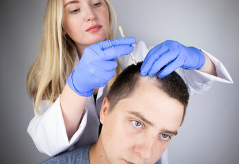 A trichologist doctor drips the serum onto the patient's hair. Treatment of alopecia. Hair loss,...