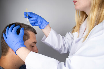A trichologist doctor drips the serum onto the patient's hair. Treatment of alopecia. Hair loss, alopecia, pruritus, burning head or seborrhea