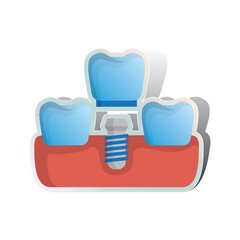 replacing missing tooth with screw on false denture