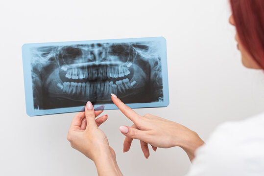 Doctor orthodontist analyzes the orthopantomogram of the patient's jaws to diagnose