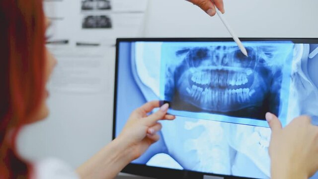 Dentist doctor checking dental x-ray orthopantomogram. Dental panoramic radiography