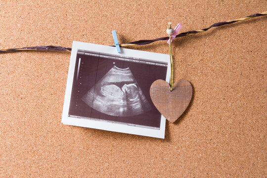 a wooden heart and a snapshot of an ultrasound scan pinned to a rope on a cork board with a small wooden clothespin, pregnancy concept, find out the gender of the child on an ultrasound
