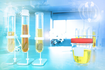 proofs in modern pollution study facility - urine quality test for epithelial cells or leucine, medical 3D illustration