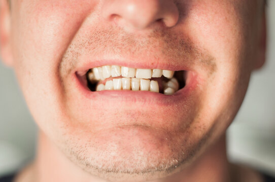 Man's Mouth Smiling. Smiling Lips of Young Casual Redhead Man