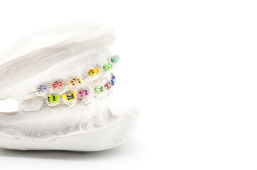 Close-up individual tooth tray Orthodontic dental theme.