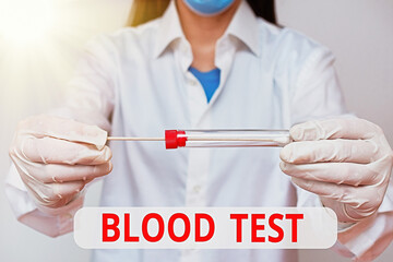 Word writing text Blood Test. Business photo showcasing Extracted blood sample from an organism to...