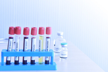 test tubes in laboratory