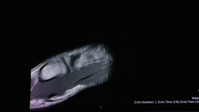 MRI scan cycling through images of a patients right ankle