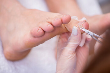 Podiatrist treating feet during procedure