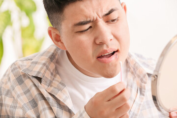 Asian man with cold sore applying ointment on his lips
