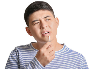 Asian man with cold sore applying ointment on his lips against white background