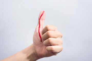 Bleeding blood from the cut finger wound. Injured finger with bleeding open cut wound. Closeup of...