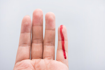 Bleeding blood from the cut finger wound. Injured finger with bleeding open cut wound. Closeup of...