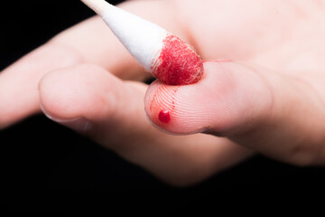 Use a cotton swab to wipe the blood at the wound on fingertips that are bleeding on dark background.