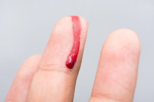 Bleeding blood from the cut finger wound. Injured finger with bleeding open cut wound. Closeup of finger human hand is cut hurt bleeding with bright red blood. 