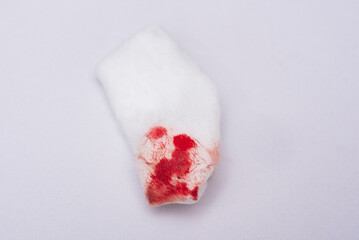 A cotton wool swab with blood stains after use, from cleansing the bleeding wound on a white...