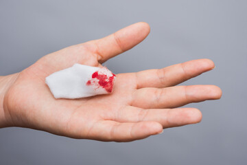 Hands are carrying a cotton swab with blood stains after use, from cleansing the bleeding wound on a white background.