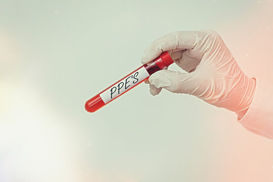 Writing note showing Ppe s is. Business concept for Specialized equipment for protection against health and safety hazard Extracted blood sample vial ready for medical diagnostic examination
