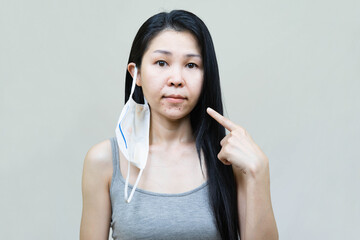 Young asian woman wearing medical face mask  her hand point at pimple on chin,Skin allergy,acne from wearing a mask. - Powered by Adobe