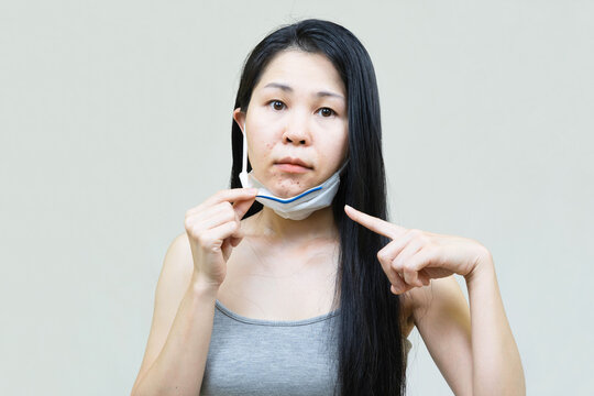 Young asian woman wearing medical face mask  her hand point at pimple on chin,Skin allergy,acne from wearing a mask.