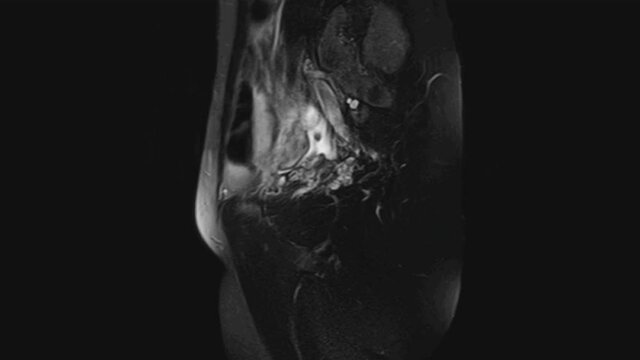 MRI of the female pelvic organs, abdominal cavity, gastrointestinal tract and bladder