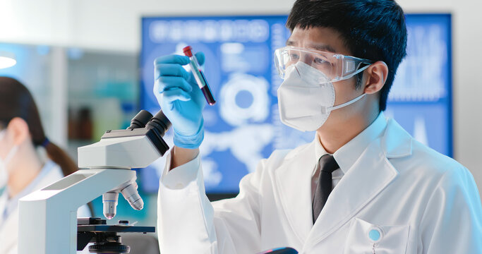 blood test result concept