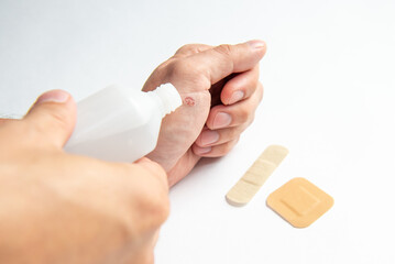 disinfecting the wound on the hand and applying a patch