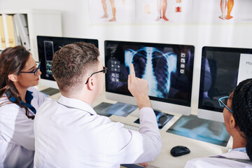 Group of doctors discussing chest x-ray on screen of computer when trying to make a proper diagnosis