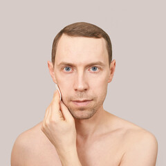 Obraz premium Man doing home skin care routine. Cotton pad near male chin. Dermatology treatment. Cream facial apply. Cosmetology guy portrait. Cleaning lotion. Skincare hygiene