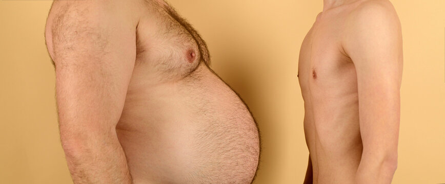 Fat Vs Slim Man, Obese Men. Skinny Torso Vs Fat Men Stomach.