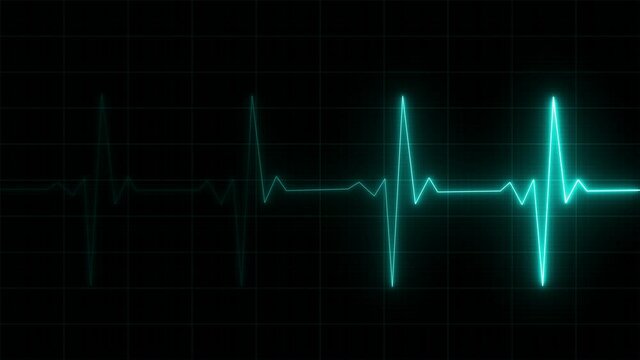Heart Rate Monitor Electrocardiogram Ekg Or Ecg Looping background