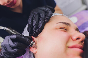 Woman cleaning nose skin pores using vacuum blackhead remover, cosmetic procedure.